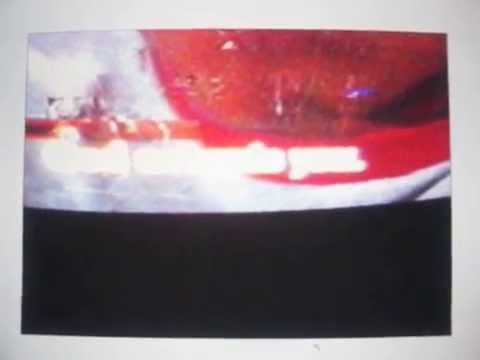 Video 3 - Mike Hessman