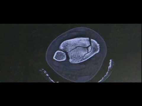 Video 5 - Allison Baver